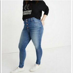Madewell 10” High Rise Skinny Jean